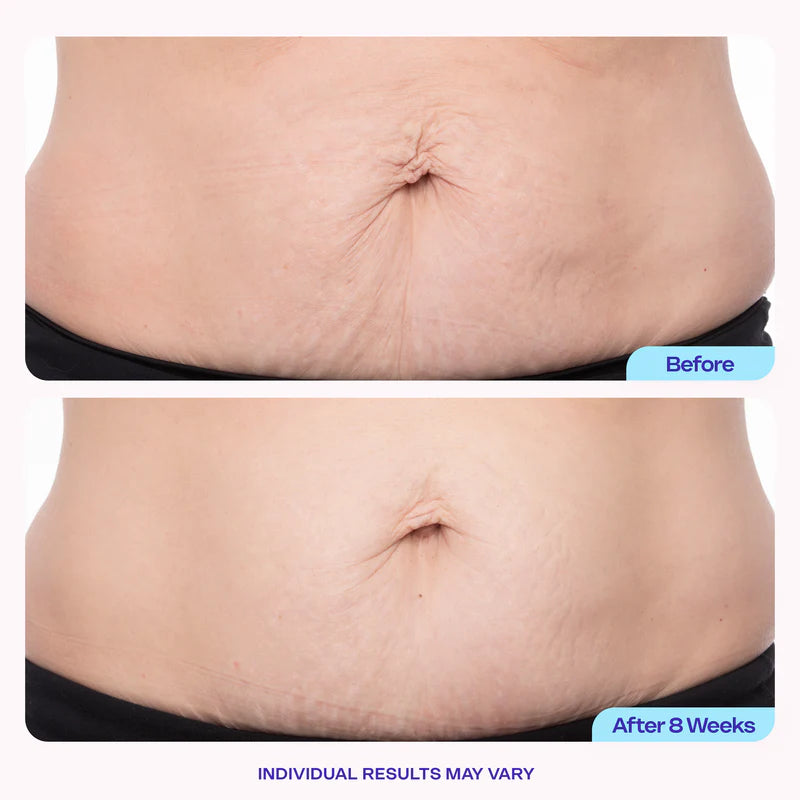 Molmaro Tighten & Smooth Belly Cream